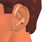 Anti-Tragus